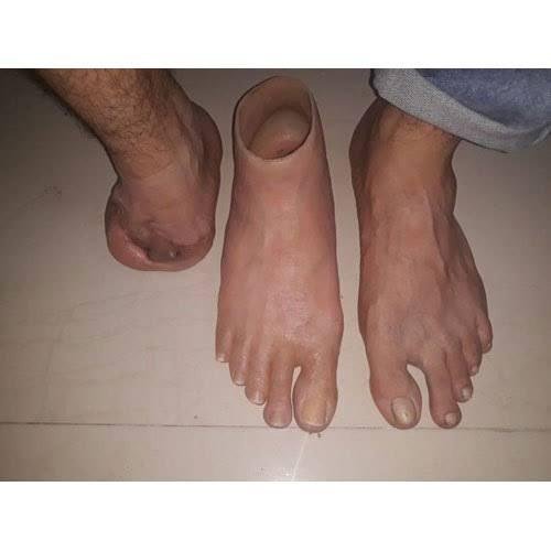 SILICON FOOT